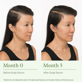 DIVI, Scalp Serum revitalize + detoxify, 30ml