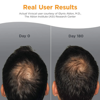 Viviscal, Man, Advanced Hair Health, 60 Tablets