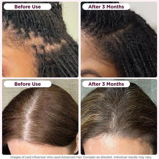 Nature's Bounty Optimal Solutions Hair Growth, 90 Capsules